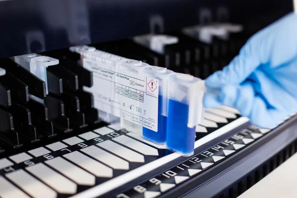 Delle provette con liquidi reagenti blu vengono inserite in una macchina per analisi biochimiche