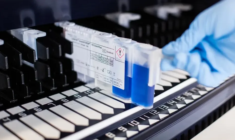 Un laboratorio di ricerca Diasorin. Provette contenenti liquido blu.